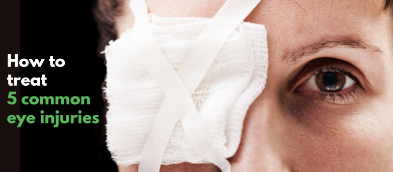 How to treat 5 common eye injuries